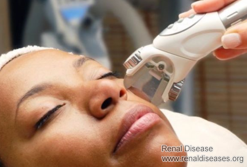 How to Stop for Being Darker Skin of A Dialysis Patient