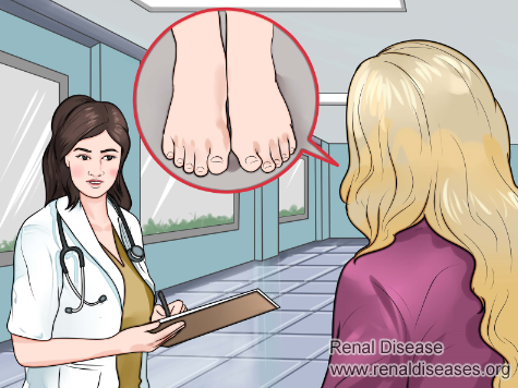 Nephrotic Syndrome, Swelling Badly on and off: What to Do