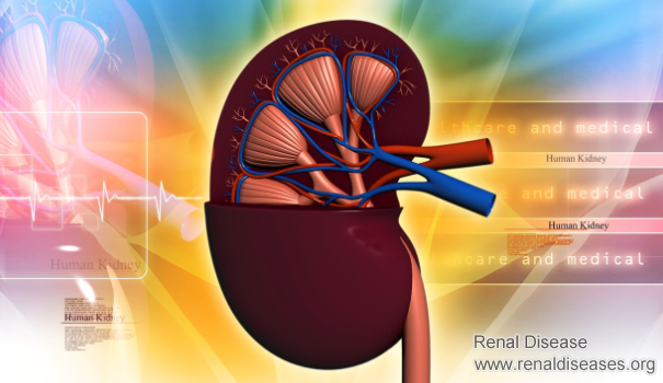 Should I Cleanse My Kidney if I Have Kidney Failure