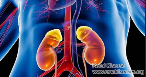 5 Points Improve Long-Term Survival of Transplanted Kidneys